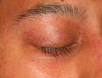 EMR010122Figure 1 color.jpg