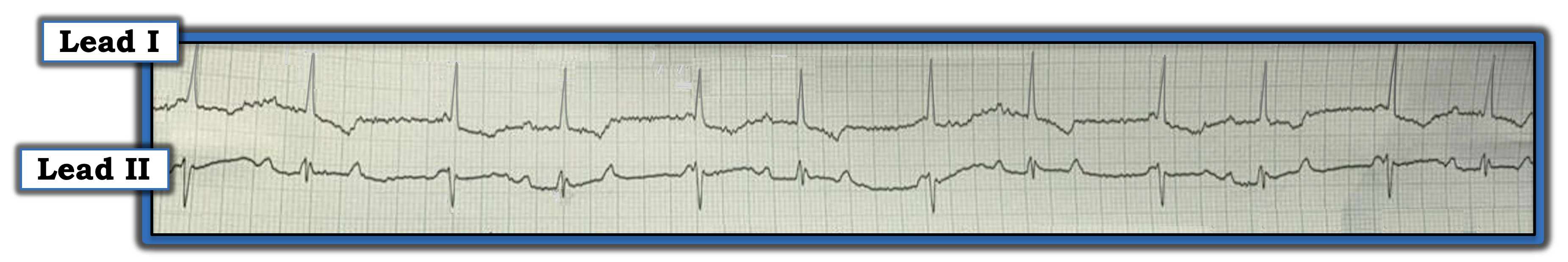 ECG Review 368 Figure.png