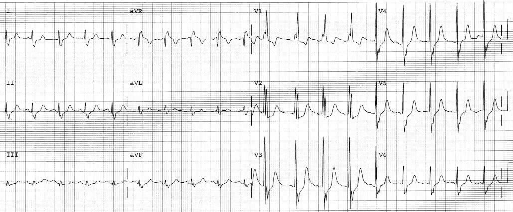 Figure 8_Figure 9 - RVH.jpg
