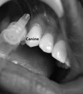 Infraorbital 1