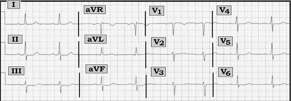 ECG%20Aug.%2015-FIGURE.jpg