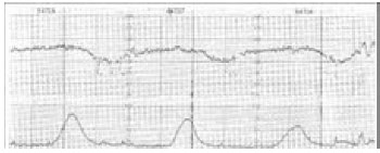ECG2_0001.jpg