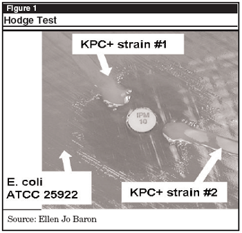 Figure 1 Hodge Test