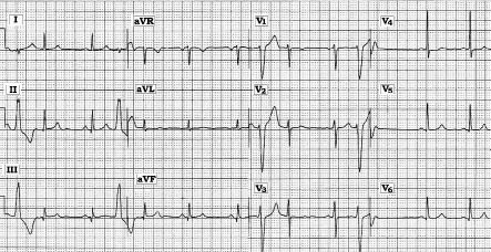 ECG #229Mod.jpg