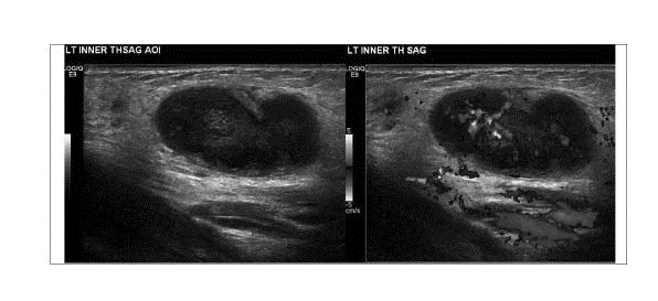 PDMR0813RAfig5opt.jpg