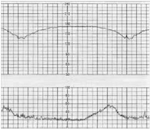 ECG1_0001.jpg
