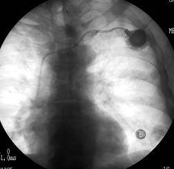 EMR080111fig1A.pdf