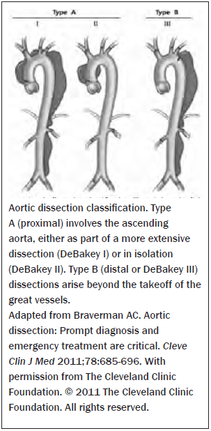 Classification