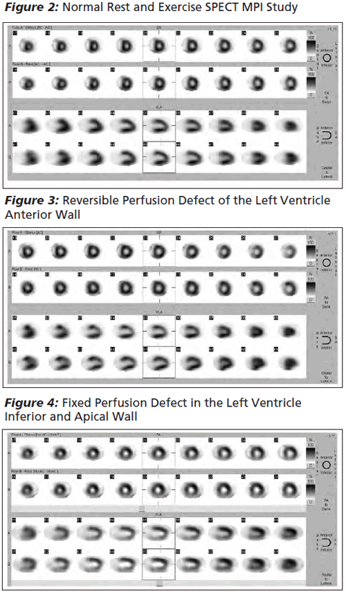 Figure 2-4
