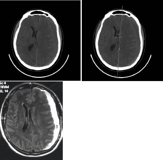 EMR041210fig1.pdf