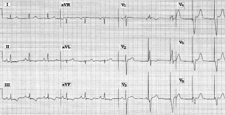 ECG #228Mod.jpg
