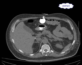 EMR081511fig2A.pdf