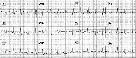 ECG #226Mod.jpg