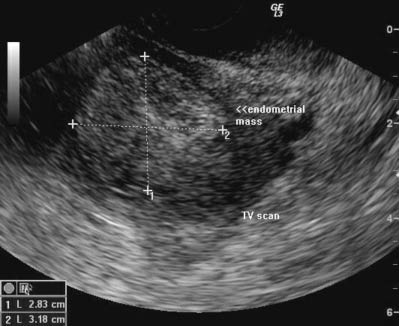 EMR042511fig3.jpg
