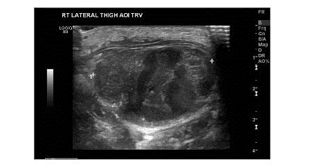 PDMR0813RAfig2opt.jpg