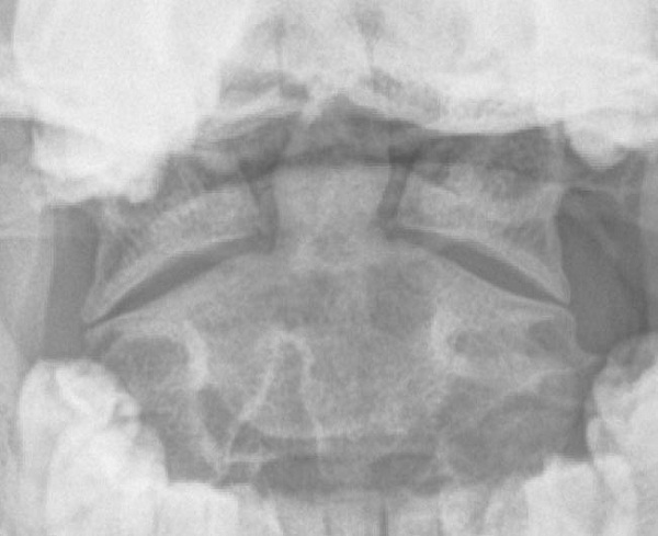 EMR061812 fig OMO view.jpg