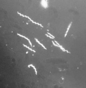 Fig%203%20borrelia%20bergdorferi.jpg