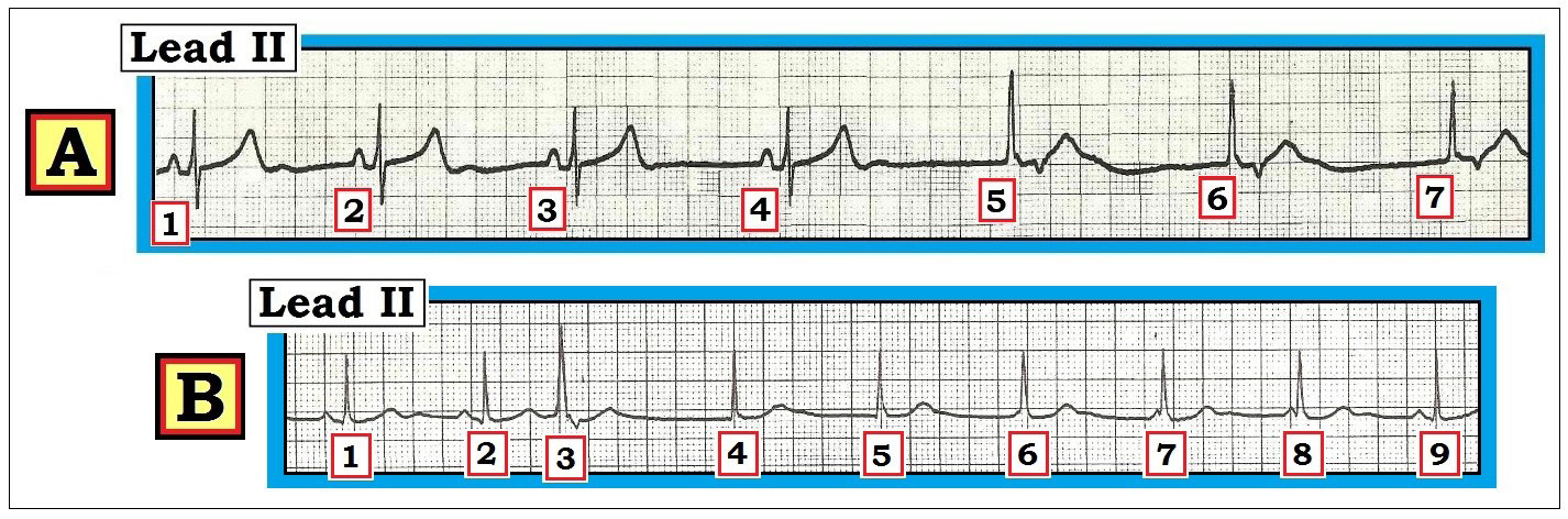 ECG%20Jan.%2015-FIGURE.jpg