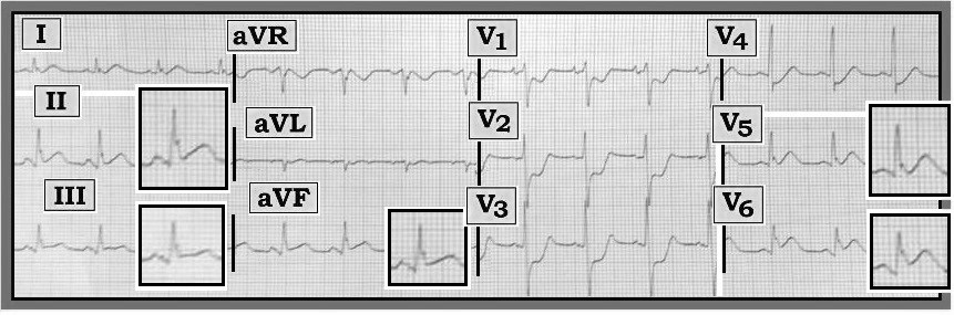 ECG%20July%2015-FIGURE.jpg