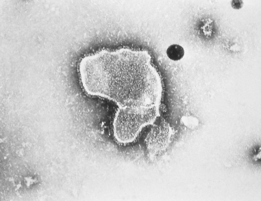 RSV%20imagePHIL_2175.tiff