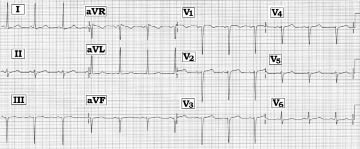 ECG #235.tif