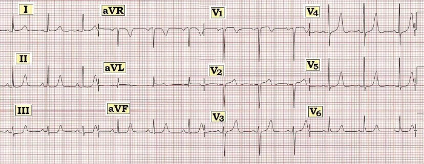 ECG #237.JPG
