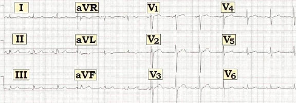 ECG #238.JPG