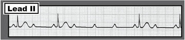 ECG #240 (grey).jpg