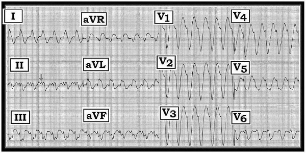 ECG #242 (grey).jpeg