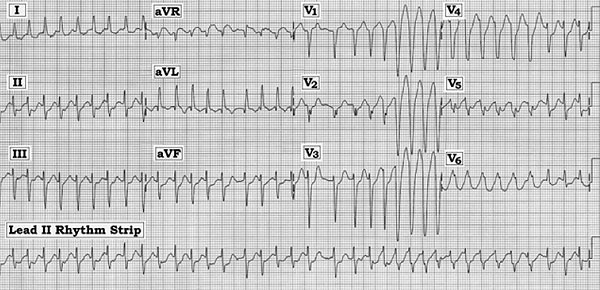 ECG Rev-#232.tif