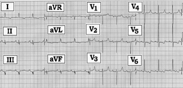 ECG Rev-#233.tif