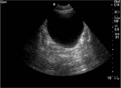 EMR021411fig15 normal bladder_0001.jpg