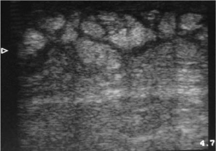 EMR021411fig19 cellulitis_0001.jpg