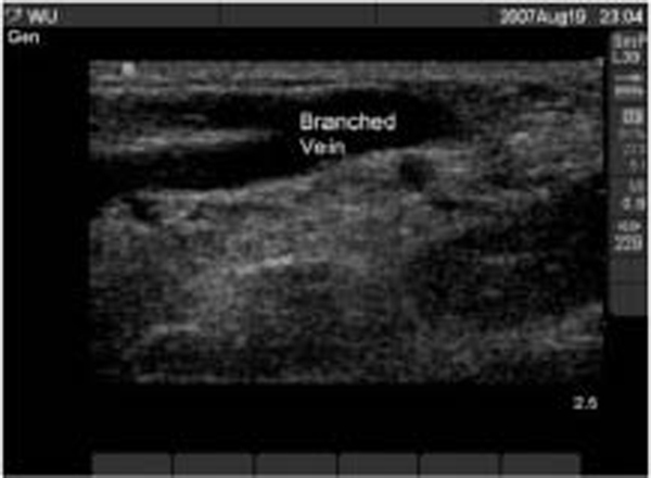 EMR021411tubular shaped vein fig2_0001.jpg