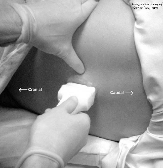 EMR022811fig11 longitudinal probe placement for LP_0001.jpg