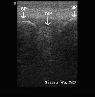 EMR022811fig12 spinous processes longitudinal_0001.jpg