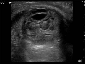 EMR022811fig21 globe rupture_0001.jpg