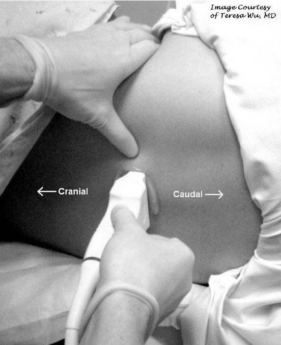 EMR022811fig9 transverse probe placement for LIP_0001.jpg