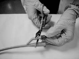 EMR080111fig2 obstructed Foley.jpg