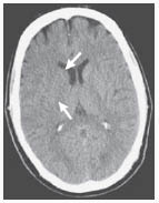 EMR 032811 unenhanced CT.pdf