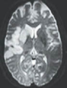 EMR 041111 diffusion weighted imaging.pdf