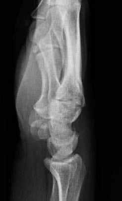 EMR 112111 fig 7 normal wrist lateral.jpg