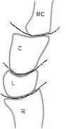 EMR 112111 fig 8 wrist diagram.jpg