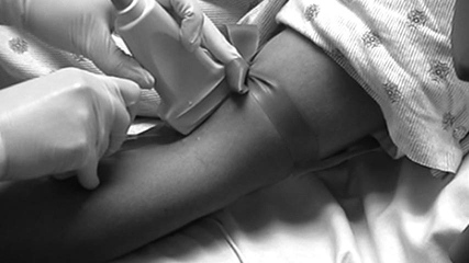 Figure 9 Ultrasound Picture PIV Insertion Long Axis.jpg