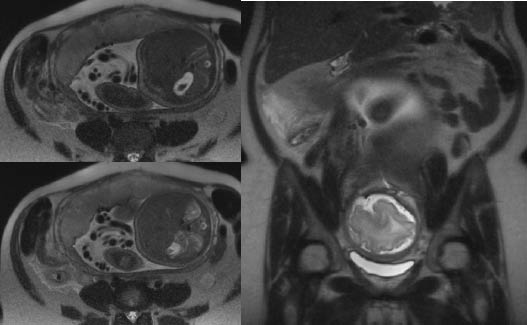 ab pain fig 2.pdf