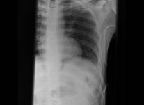 EMR elderly trauma motorcycle injuries1.pdf