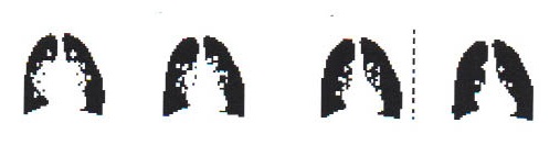 Chest Figure 2.PDF