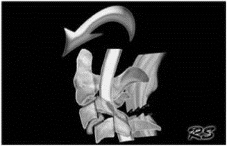 EMR061812 fig 18 bilateral facet dislocation.jpg