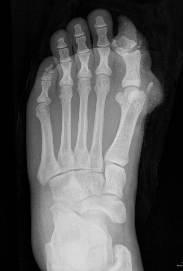 Figure 12.tif