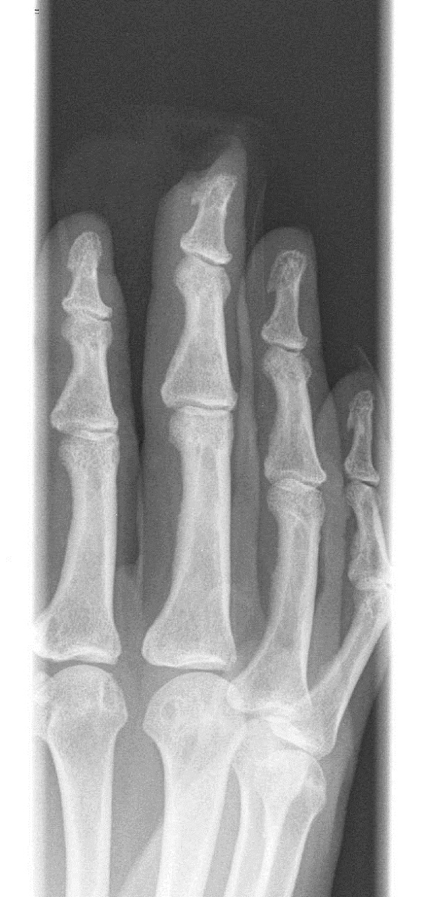 Figure 6.tif